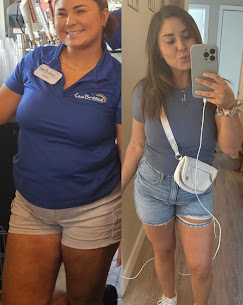 Medical weight loss with GLP-1 before and after — Clearwater FL